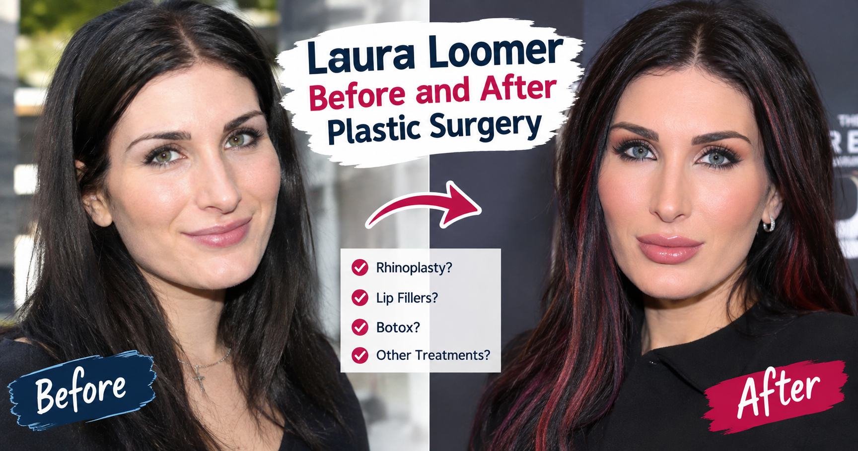 Laura Loomer Before and After Plastic Surgery