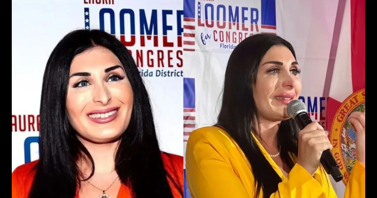 Laura Loomer Before and After Plastic Surgery